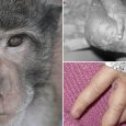 Τι είναι η ευλογιά των πιθήκων (monkeypox), ποια είναι τα συμπτώματα και πως μεταδίδεται